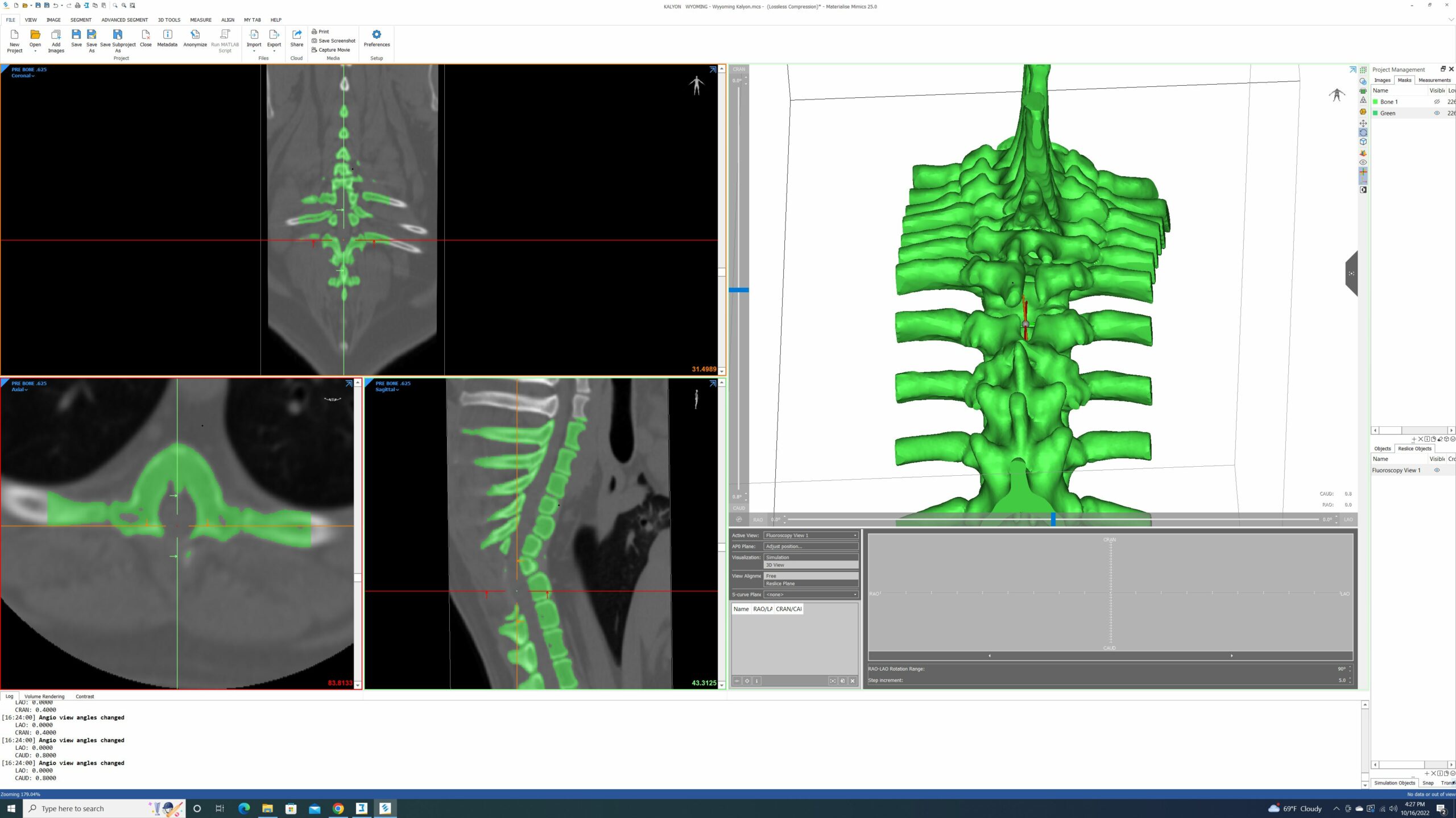 Spine mimics
